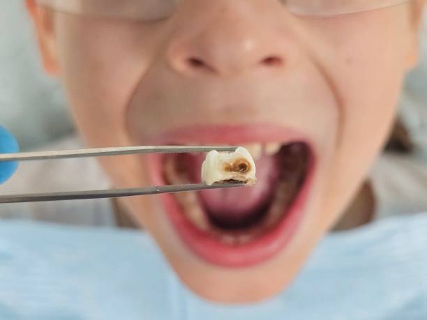 Best Weekend Emergency Dentist in Roxboro, NC
