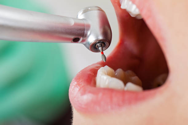Best Emergency Treatment for Dental Infections or Abscesses in Roxboro, NC